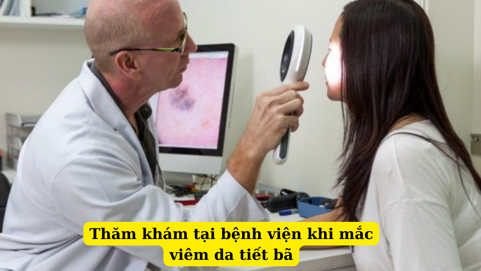 Cách điều trị viêm da tiết bã tận gốc chuẩn y khoa mà bạn không thể bỏ qua