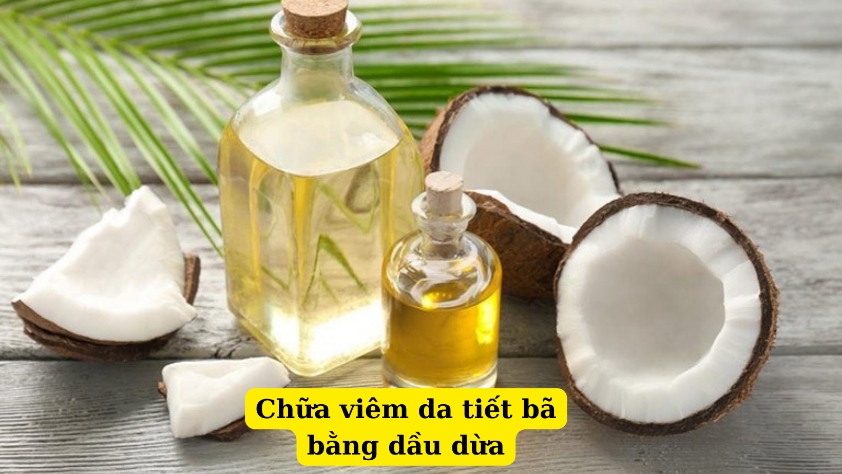 5 cách chữa viêm da tiết bã theo dân gian hiệu quả nhất