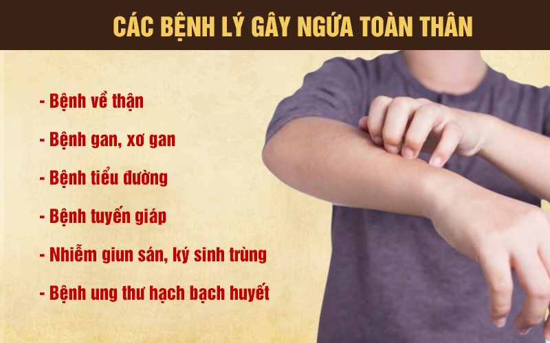 Những cách chữa ngứa da hiệu quả