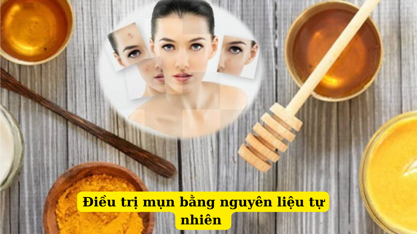 Bật mí cách trị mụn từ thiên nhiên cực hiệu quả