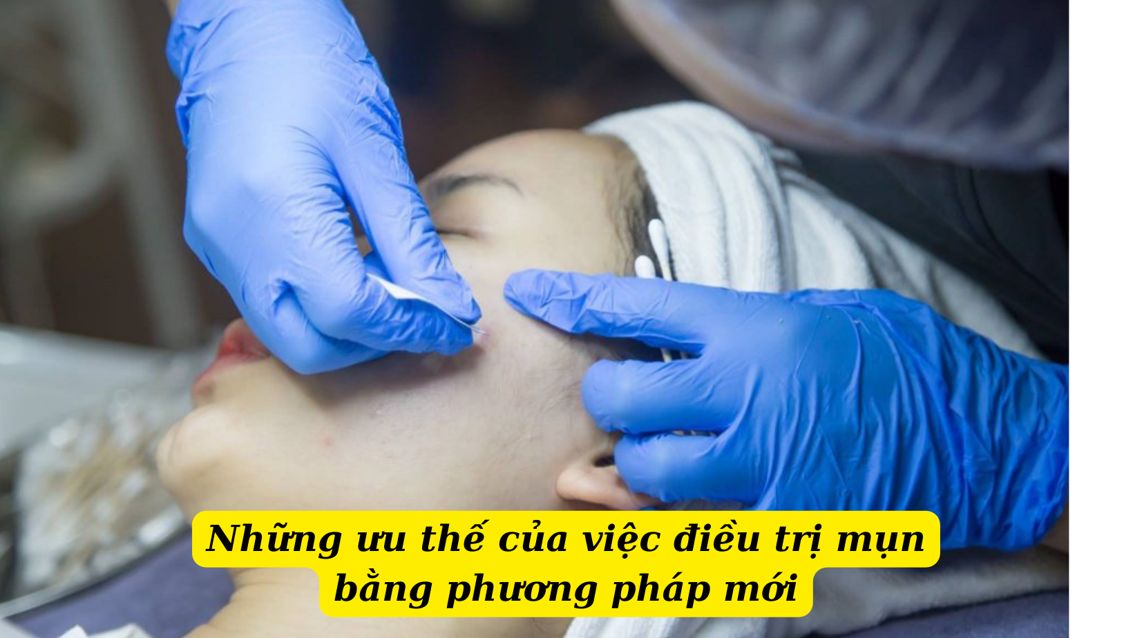 Điều trị mụn mủ hiệu quả bằng việc áp dụng phương pháp điều trị mới