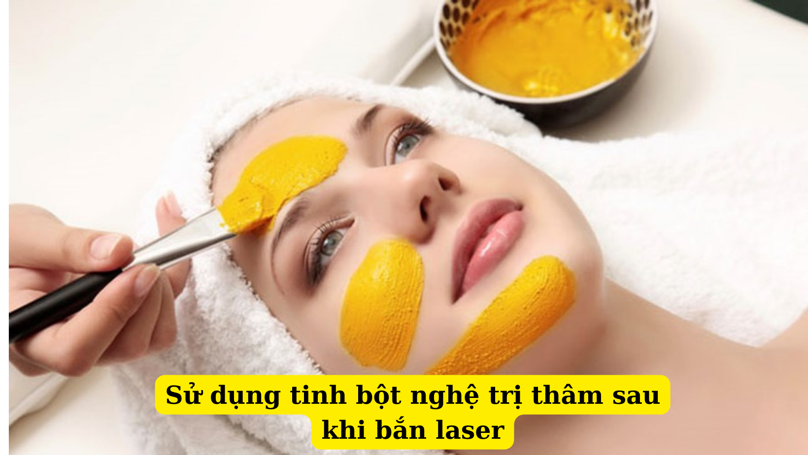 Cách điều trị thâm hiệu quả sau khi thực hiện phương pháp laser