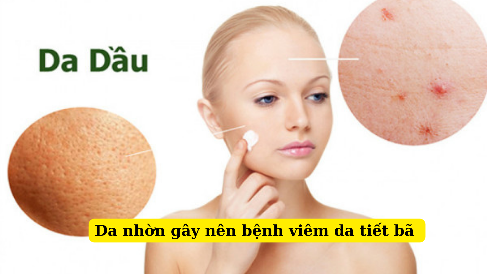 Những nguyên nhân dễ gây nên bệnh viêm da tiết bã