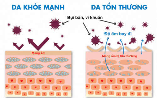 Những nguyên nhân dễ gây nên bệnh viêm da tiết bã