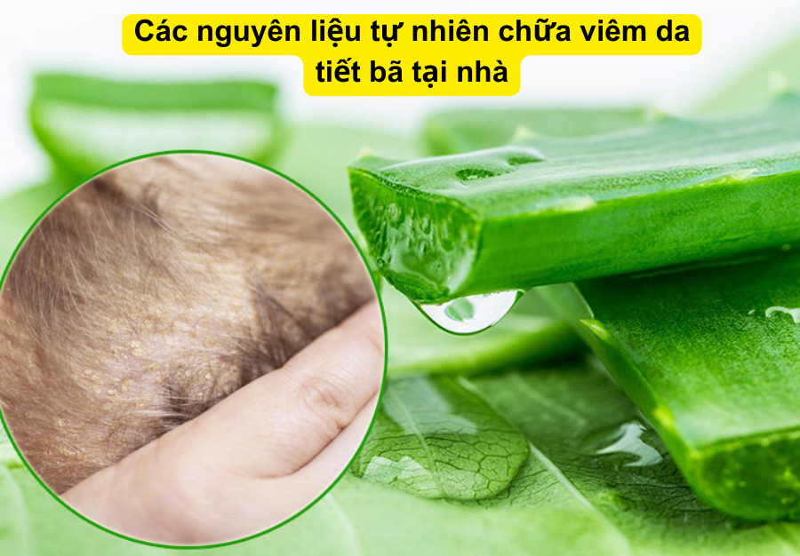 Mình đã áp dụng cách này để chữa viêm da tiết bã tại nhà