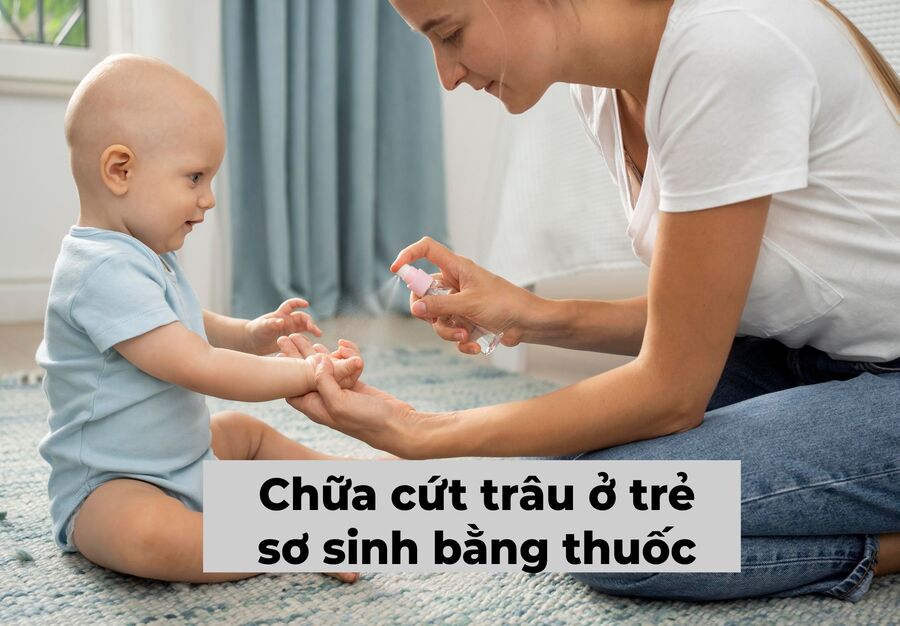 Top 4 cách chữa cứt trâu ở trẻ sơ sinh an toàn và hiệu quả nhất