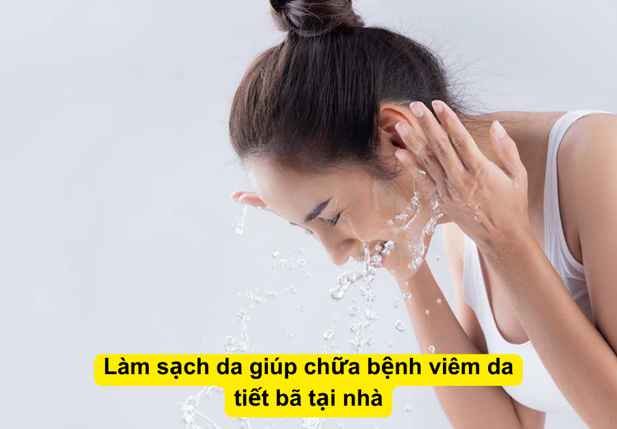 Mình đã áp dụng cách này để chữa viêm da tiết bã tại nhà